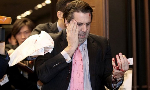 AP-mark-lippert-hurt-02-jef-15-8610-8771